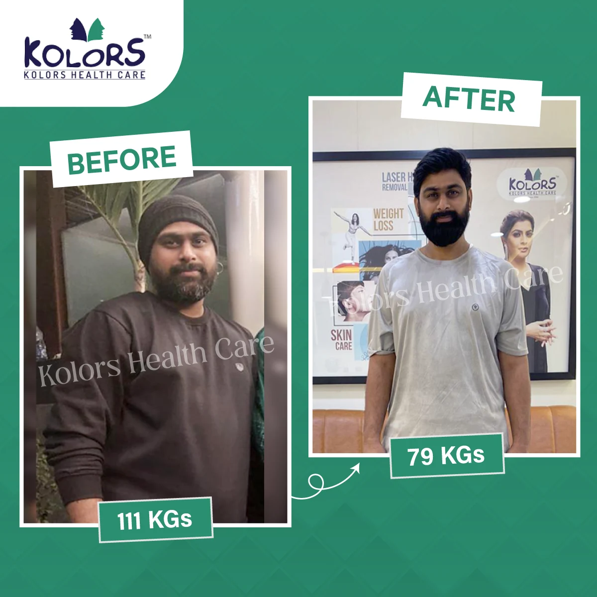 Madhubala weight loss Kolors