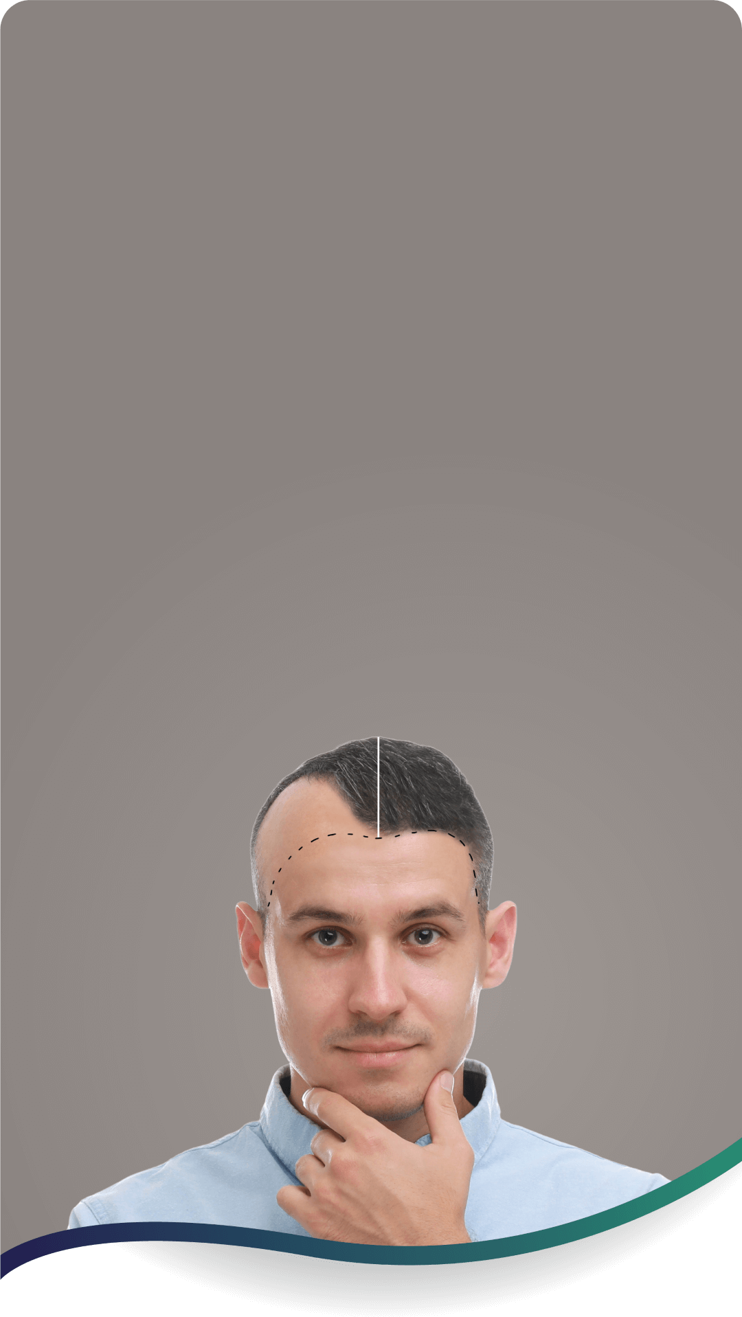 Hair Transplantation Clinic in Hyderabad, Chennai, Bangalore