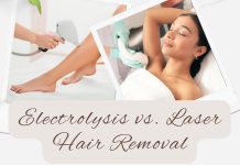 Electrolysis vs. Laser Hair Removal