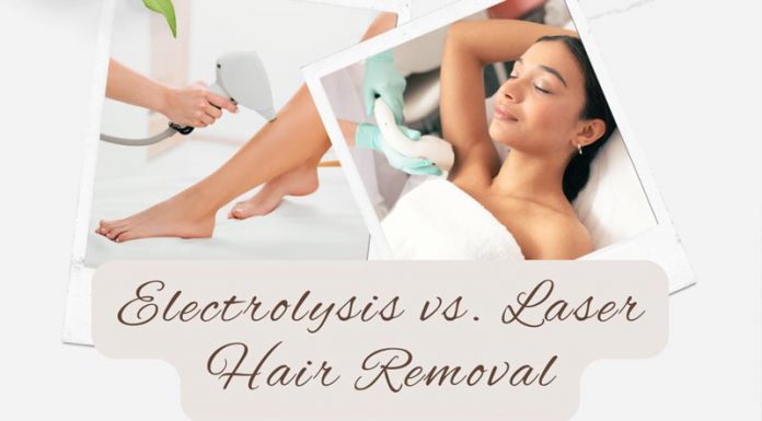 Electrolysis vs. Laser Hair Removal