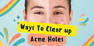 Acne Holes Scarring