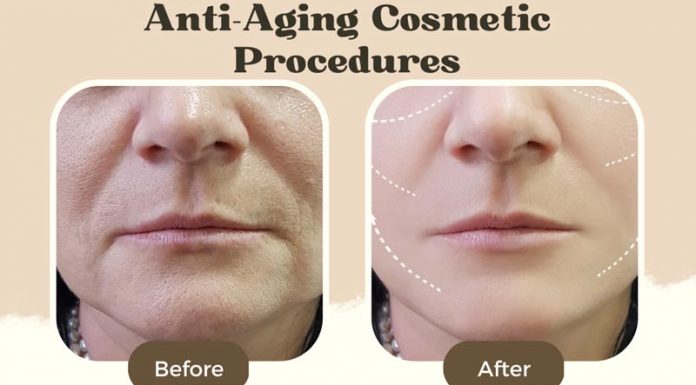 Anti Aging Cosmetic Procedures Women Before After