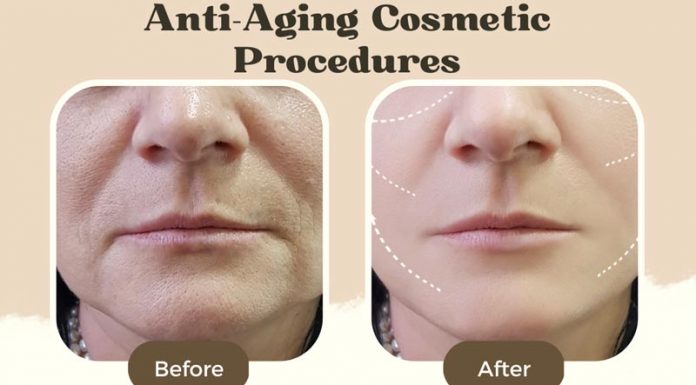 Top 4 Anti-Aging Cosmetic Procedures for Women over 50 Anti Aging Cosmetic Procedures Women Before After