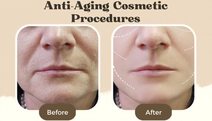 Anti Aging Cosmetic Procedures Women Before After