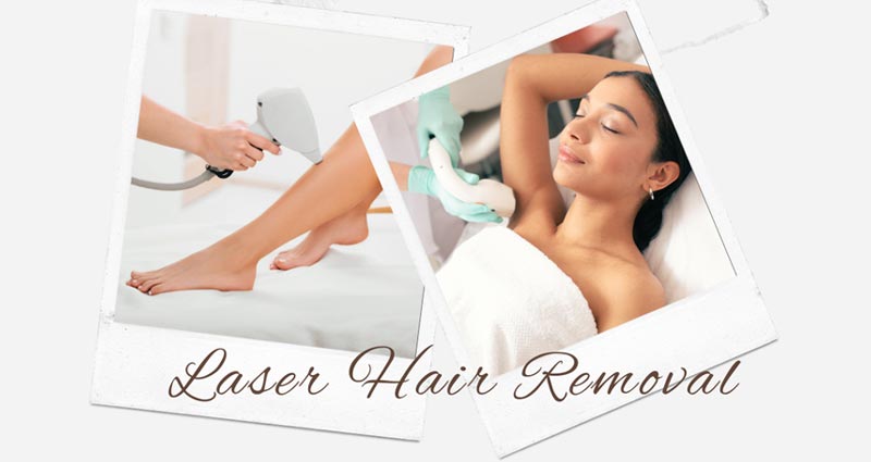 Underarms Laser Hair Removal - Laser Hair Removal Services Near Dr.  Phillips Orlando