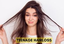 Teenage Hairloss Treatment Causes