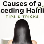 Receding Hairline Causes