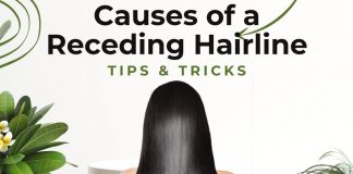 Receding Hairline Causes