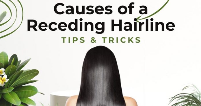 Receding Hairline Causes