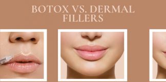 Botox Vs. Dermal Fillers