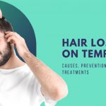 Hair Loss On Temples