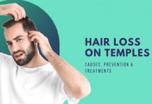 Hair Loss On Temples: Causes, Prevention & Treatments Hair Loss On Temples