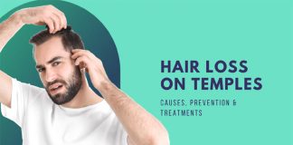 Hair Loss On Temples