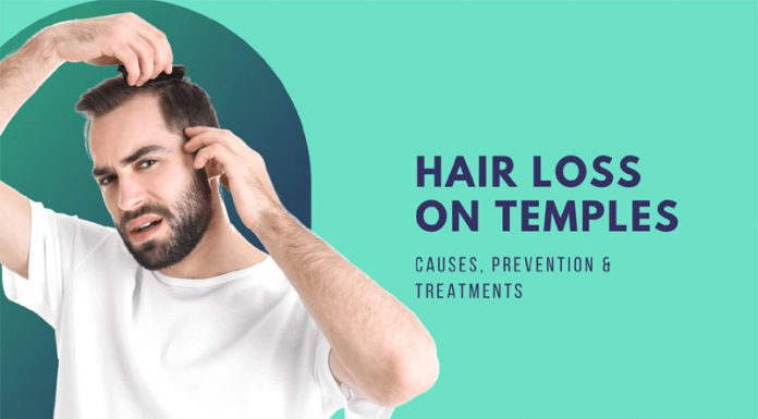 Hair Loss On Temples