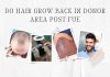 FUE Hair Donor Area
