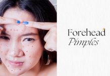 Forehead Pimples Reasons
