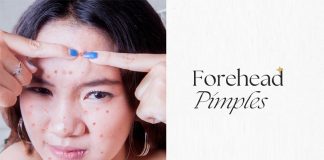 Forehead Pimples Reasons