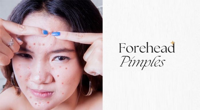 Forehead Pimples Reasons