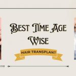 Hair Transplant Age