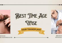 Hair Transplant Age
