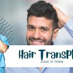 Hair Transplant Cost India