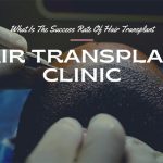 Hair Transplant Success Rate