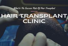 Hair Transplant Success Rate