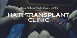 Hair Transplant Success Rate