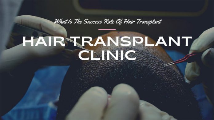 Hair Transplant Success Rate