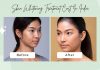Skin Whitening Treatment Cost India