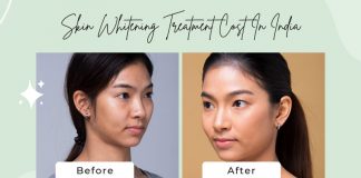 Skin Whitening Treatment Cost India
