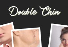 Double Chin