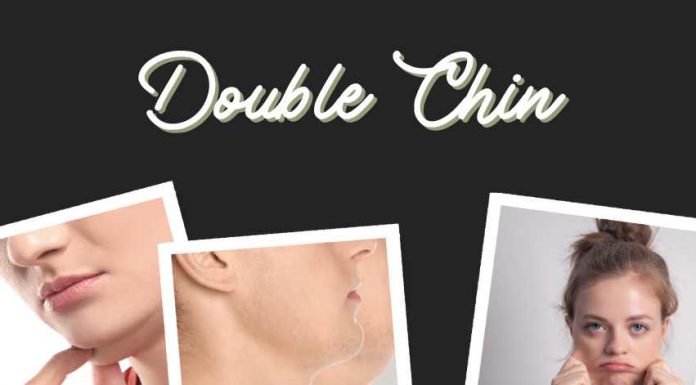 Double Chin