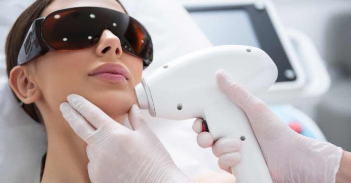 Laser Hair Removal Face