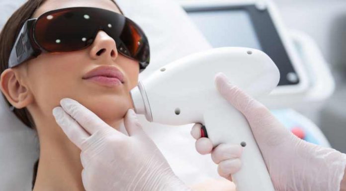 Laser Hair Removal Face