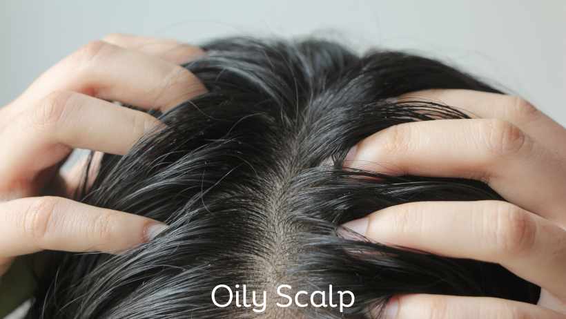 Oily Scalp