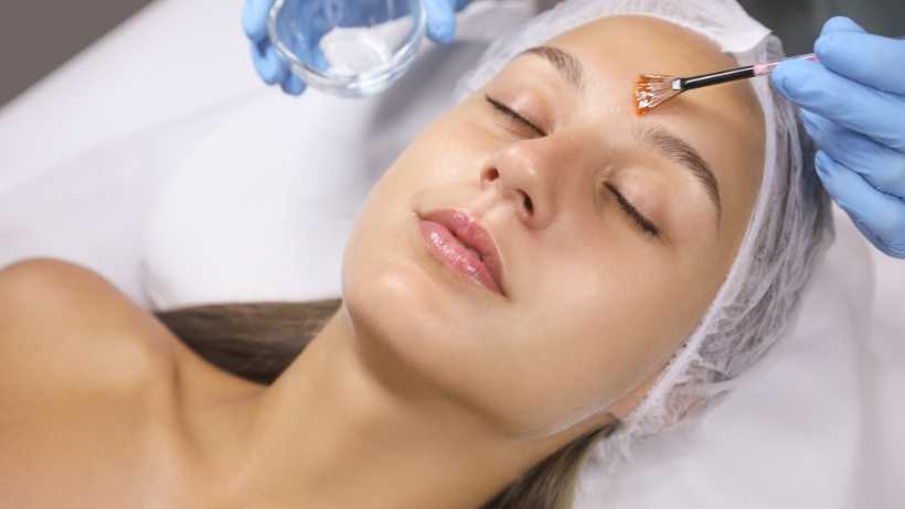 Chemical Peels