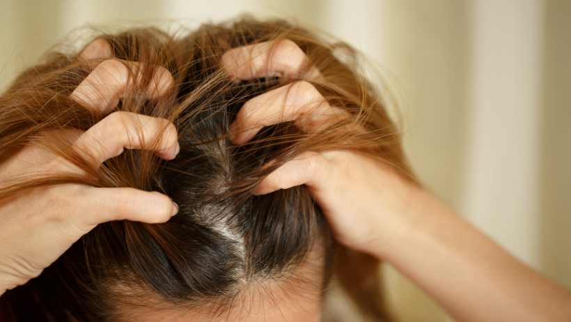 Excess Sebum Scalp