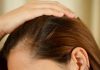 Sebum On Scalp