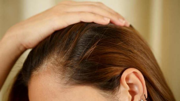 Sebum On Scalp