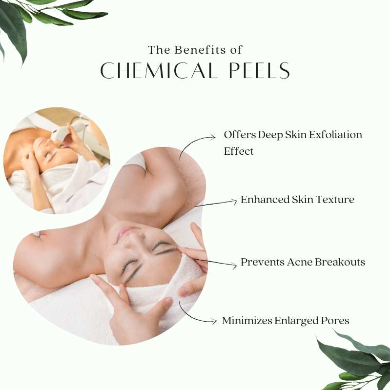 Chemical Peel Benefits