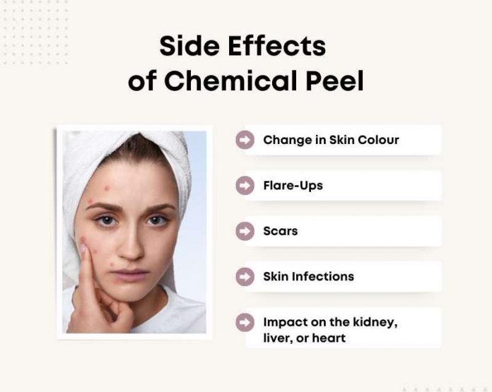 Chemical Peeling in India Cost, Types and Benefits