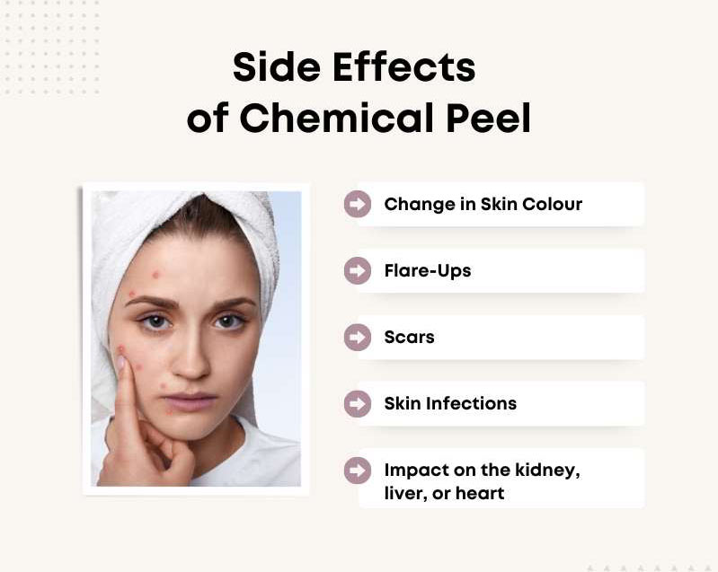 Chemical Peel Side Effects