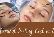 Chemical Peeling Cost India