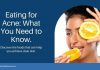 Anti-Acne Diet Guide: Choose Best Foods for Pimple-Free Skin Anti Acne Diet