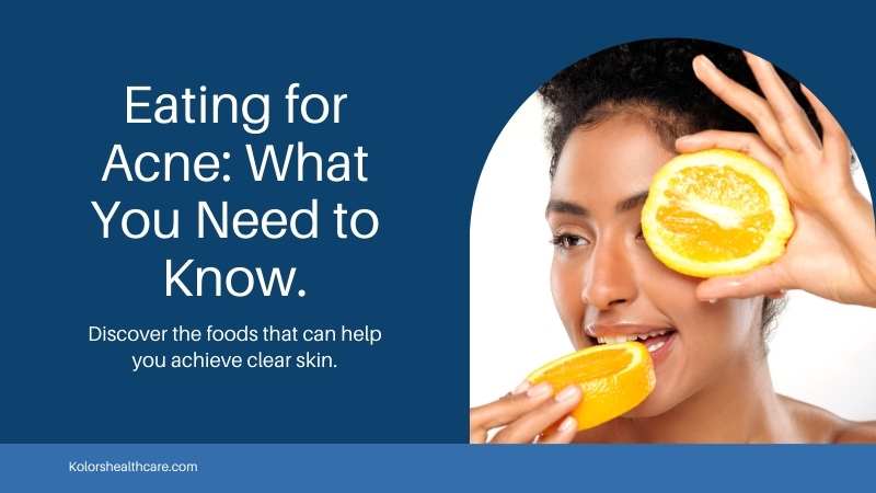 6 Foods for Clear Skin – Can Eating Certain Foods Get Rid of Acne?