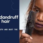 Dandruff Hair Loss