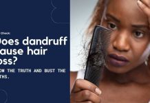 Dandruff Hair Loss