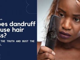 Dandruff Hair Loss