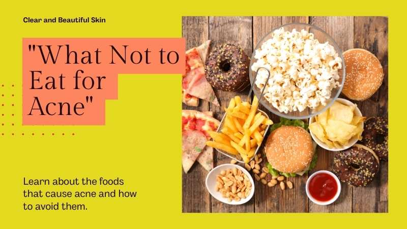 Foods Avoid Acne
